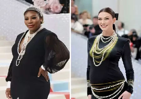 Serena Williams and Karlie Kloss Announce Pregnancy at Met Gala