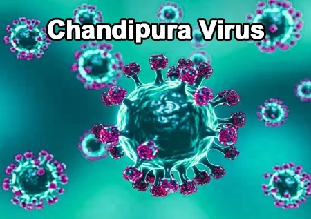 Gujarat Battles Chandipura Virus: 101 Child Deaths Amid Viral Epidemic